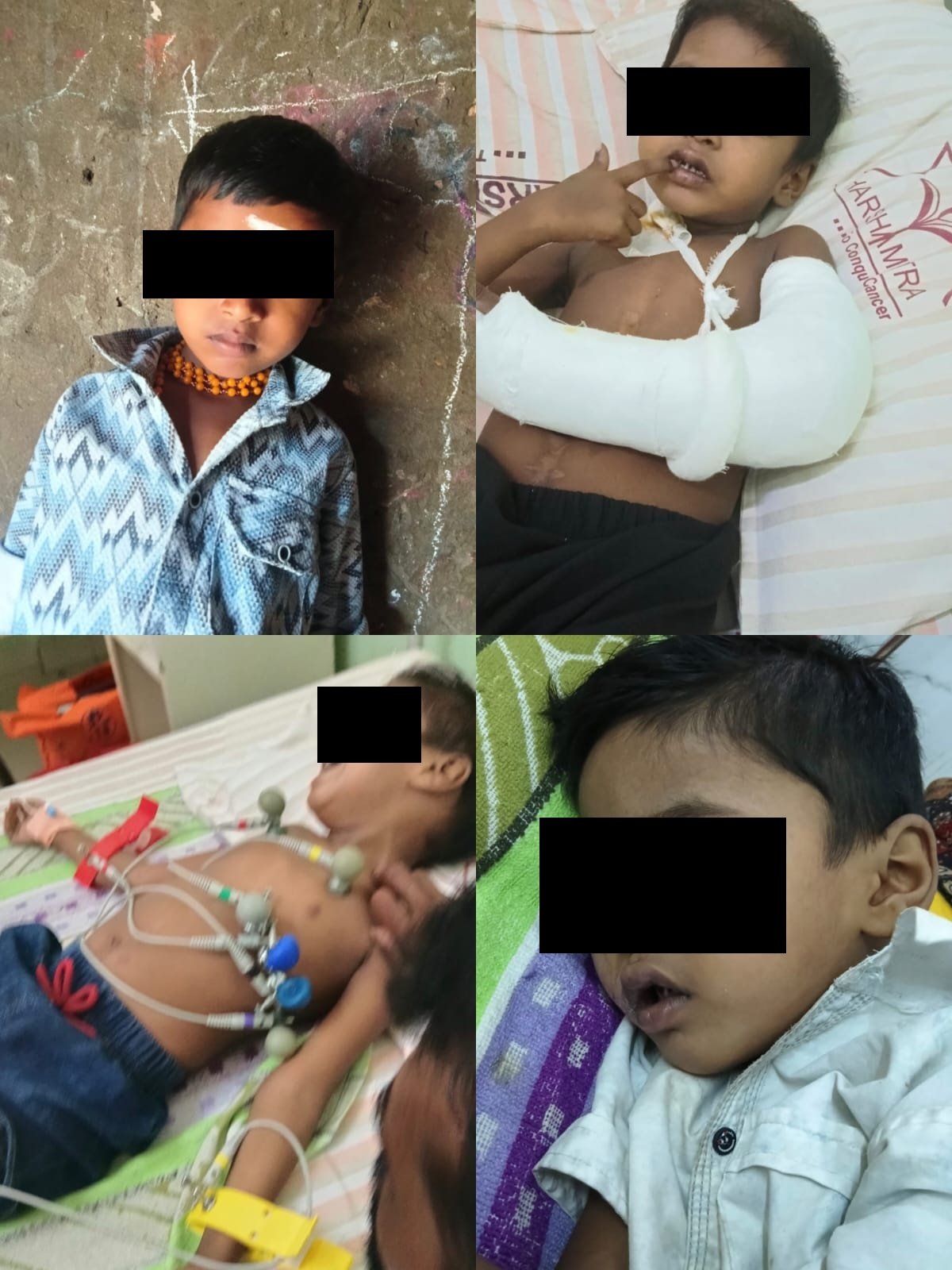 Help Rishvith with kidney cancer